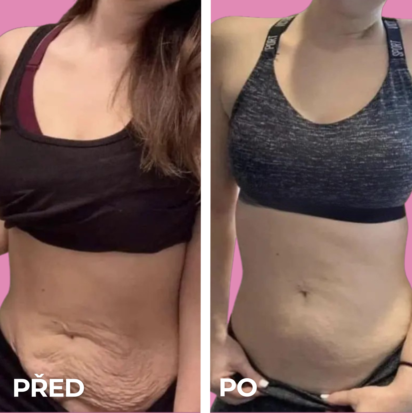 Luvea Pulse™ - Multifunkční přístroj 3v1 na zpevnění pokožky
